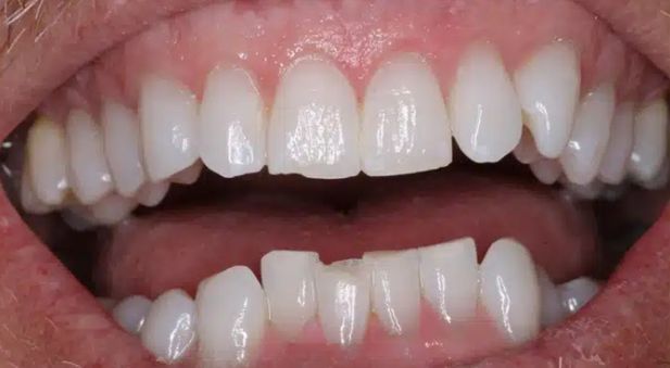 Smile before treatment