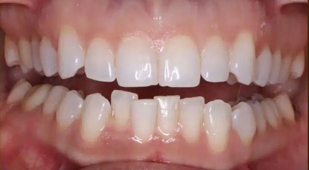 Smile before treatment