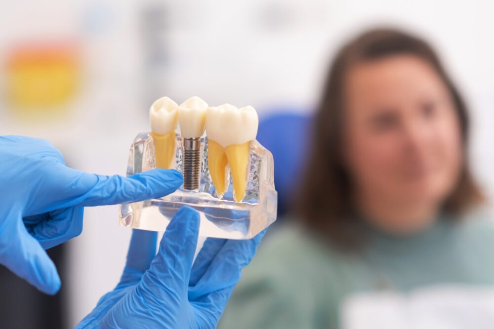 Dental Implants Clemente