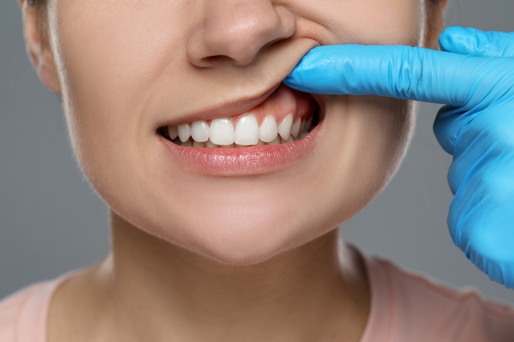 Periodontics San Clemente