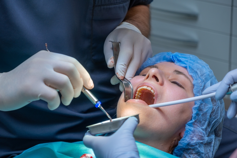 Bone Grafting San Clemente